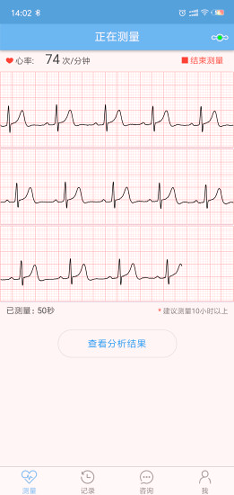 数维康心电截图