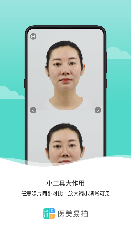 医美易拍