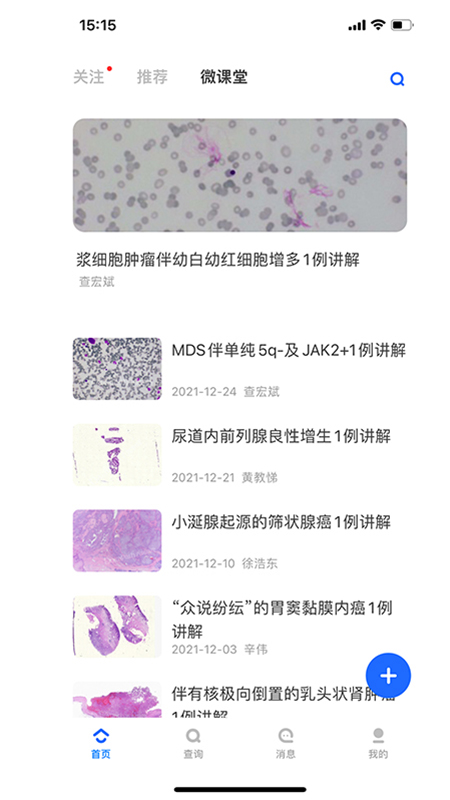 大伽病理截图2