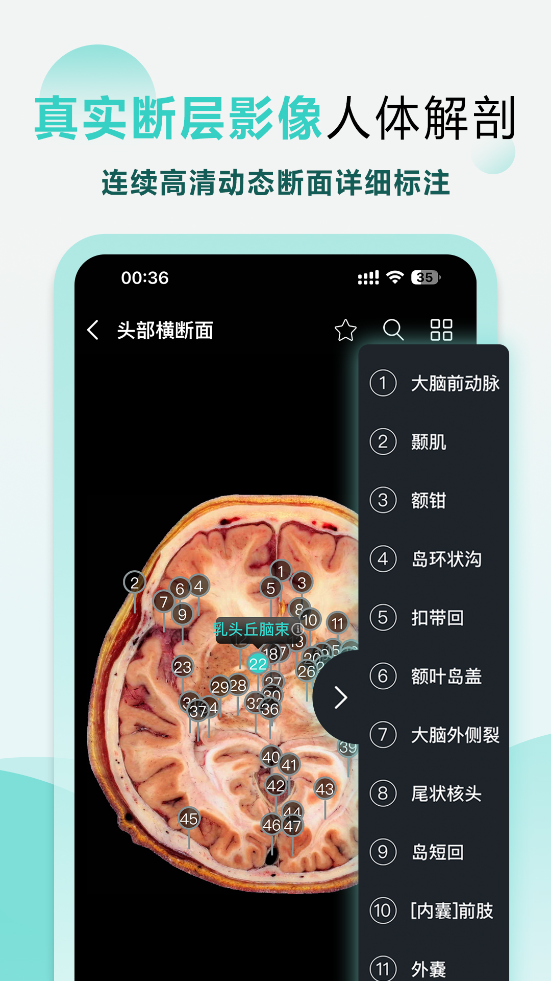 掌上3d解剖截图4