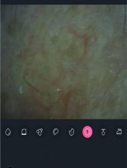 护肤ai检测截图3